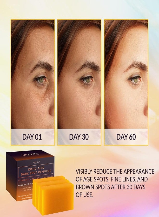 VALITIC Kojic Acid Dark Spot Remover Soap Bars with Vitamin C, Retinol, Collagen, Turmeric - Original Japanese Complex Infused with Hyaluronic Acid, Vitamin E, Shea Butter, Castile Olive Oil (3 Pack) - Image 2